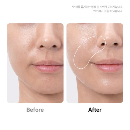 MEDICUBE Age-R Booster Pro Pink facial treatment device, 1 pcs.