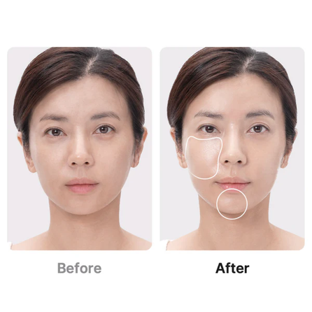 MEDICUBE Age-R Booster Pro Black facial treatment device, 1 pcs.