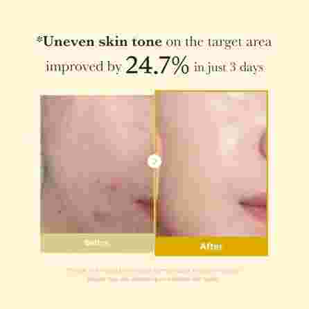 MEDICUBE Kojic Acid Turmeric Night Wrapping facial mask, 75 ml