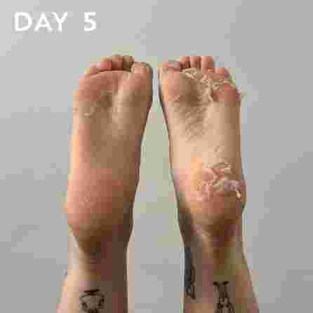MASKOLOGY  Peeling Foot foot mask, 1 pair