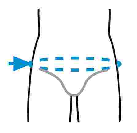 PRIM Spine Care+ (XXL) muguras ortoze, 1 gab.