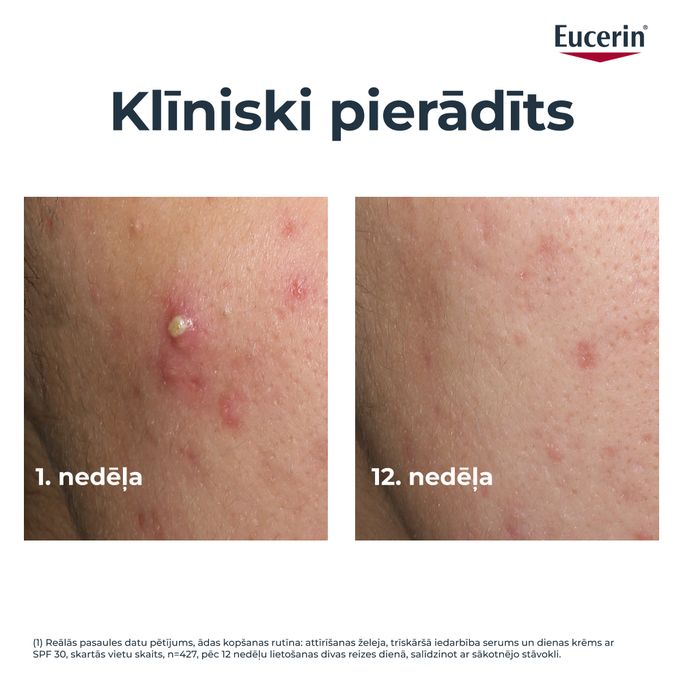 EUCERIN DermoPure Clinical Triple Correcting fluīds, 40 ml - 3