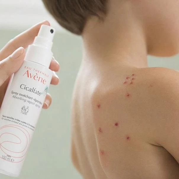 AVENE Cicalfate+ sprejs, 100 ml - 2