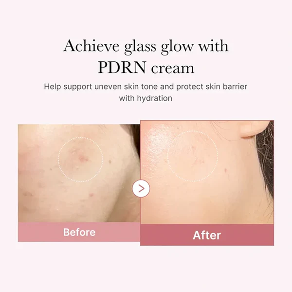 MEDICUBE PDRN Pink Hyaluronic Moisturizing sejas krēms, 50 ml - 2