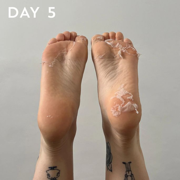 MASKOLOGY  Peeling Foot maska kājām, 1 pāris - 3