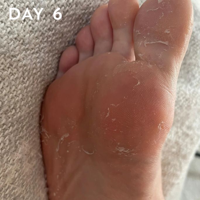 MASKOLOGY  Peeling Foot maska kājām, 1 pāris - 4