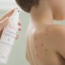 AVENE Cicalfate+ sprejs, 100 ml thumbnail 2