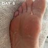 MASKOLOGY  Peeling Foot maska kājām, 1 pāris thumbnail 4